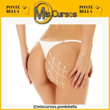 Curso Online de Masaje para Levantamiento de Glúteos